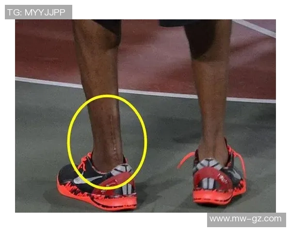 足球球星跟腱断裂伤情分析及康复过程揭秘